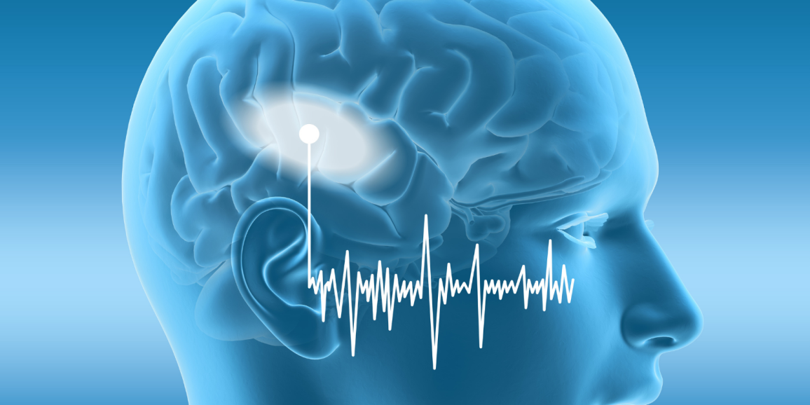 rh tertiary auditory cortex function