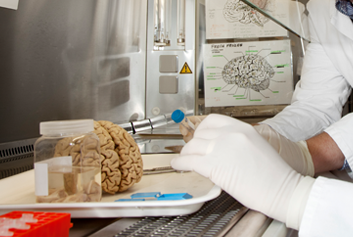 Neurological Foundation Human Brain Bank